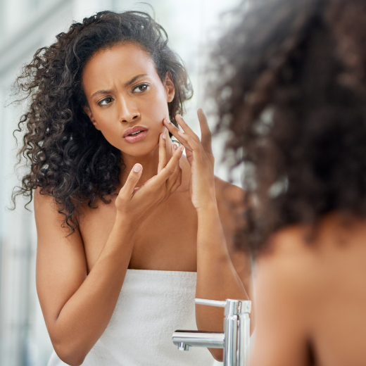 Myth or Not: Can The Sun Cure Acne?
