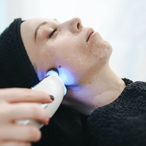 Five Ways to Banish Acne Scars