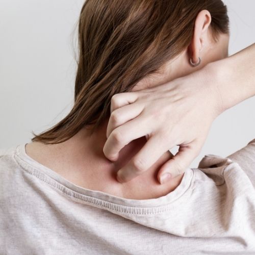 What Types of Products are Best for Eczema Prone Skin?