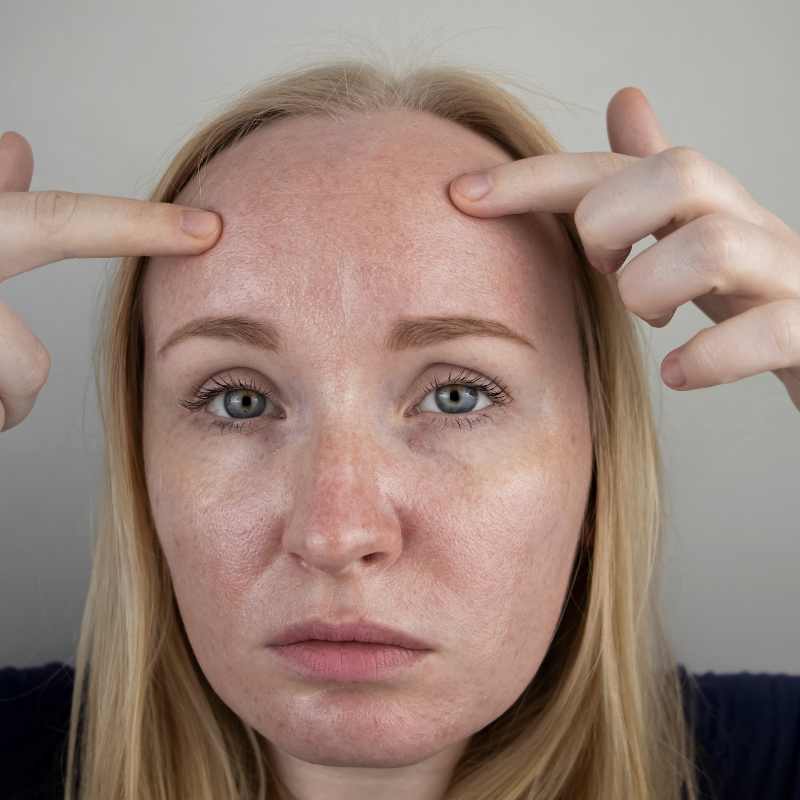 The Perfect Skin Care Routine for Oily Skin