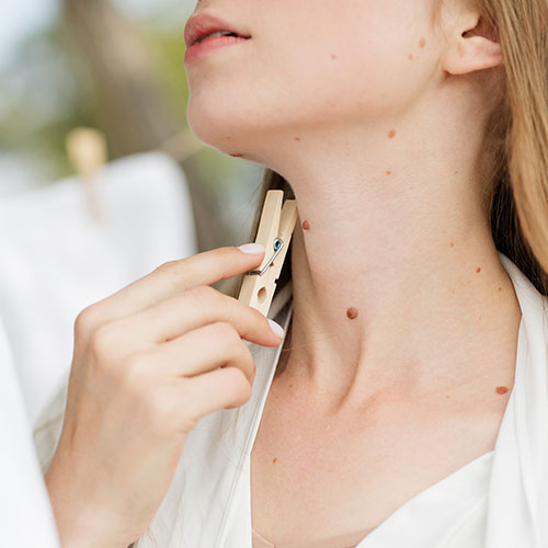Mole Patrol: Everything You Need to Know About Moles