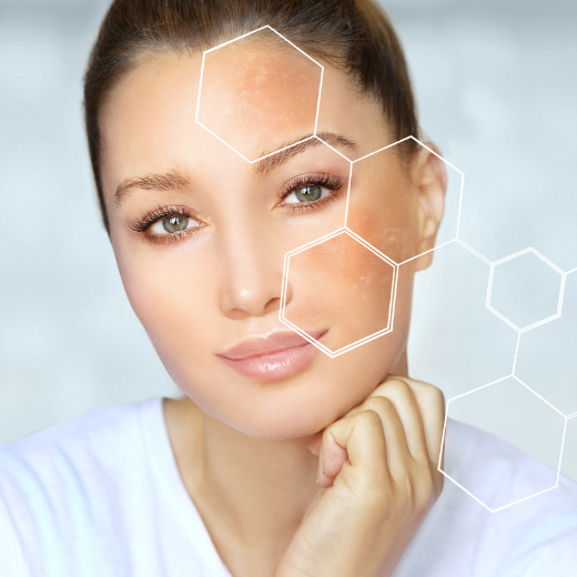 Rosy Reds: Skin Care Tips for People with Rosacea