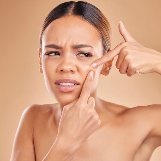 SOS: Skin Freakout? Here's How to Calm the Chaos