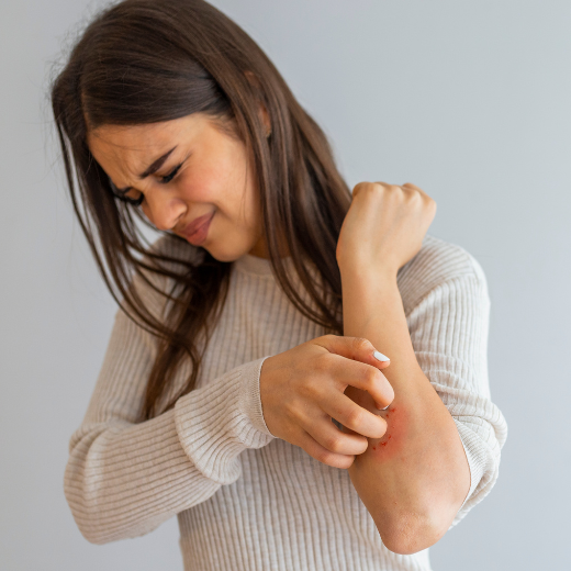 Skin Care Tips for People with Eczema