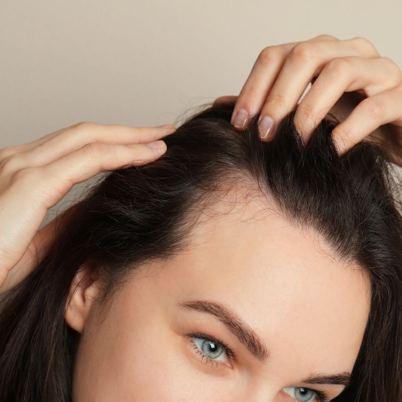 Thinning Hair