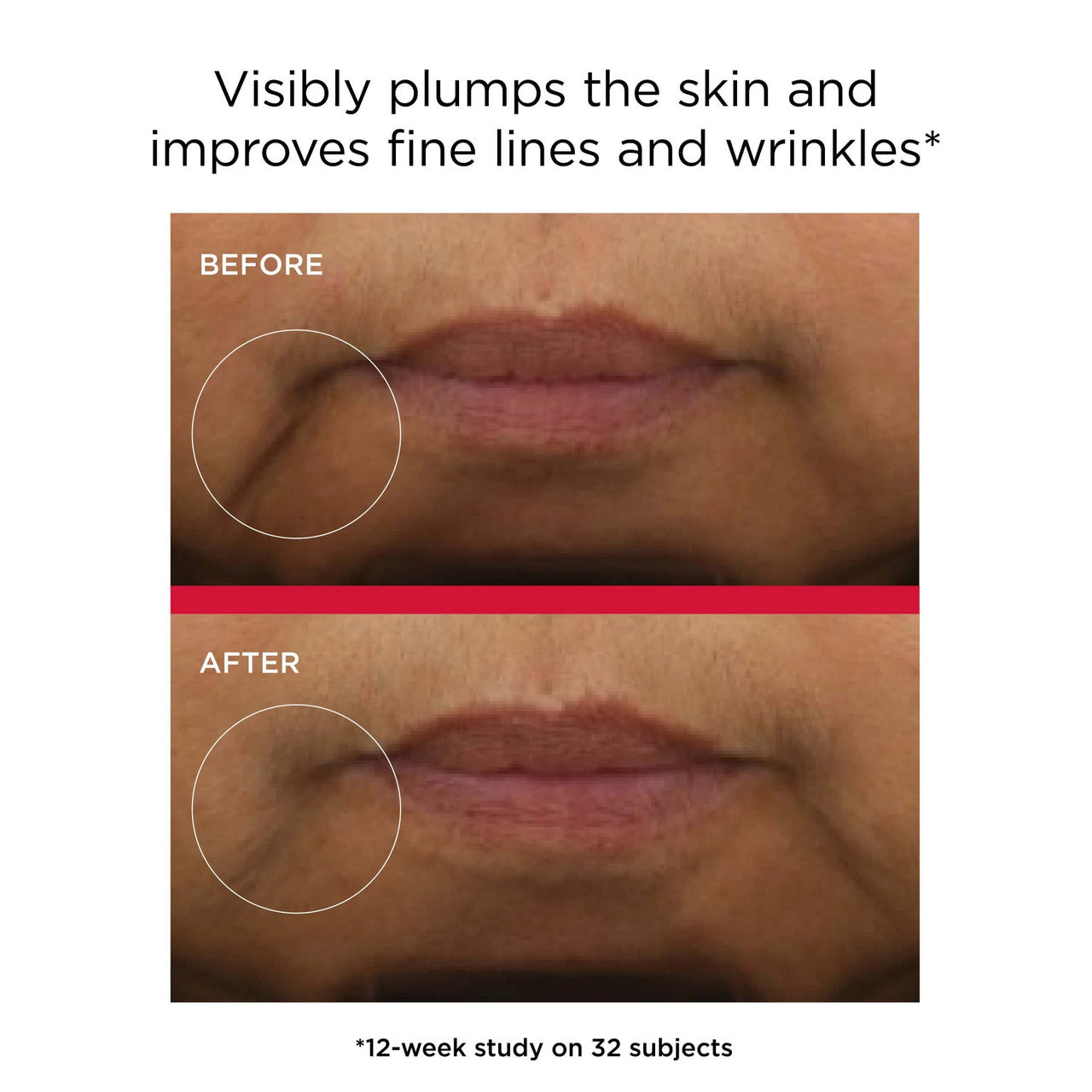 EltaMD UV Daily Hydration+ 1.7 fl oz - Skin Elite - Clinical Result Images
