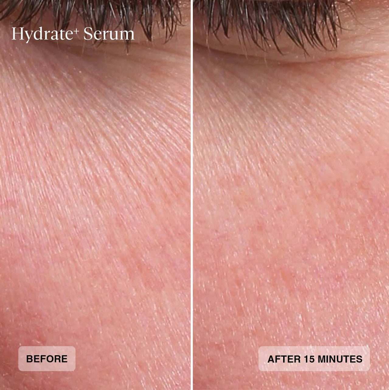 Senté Hydrate+ Serum 1 fl oz - SkinElite - before and after