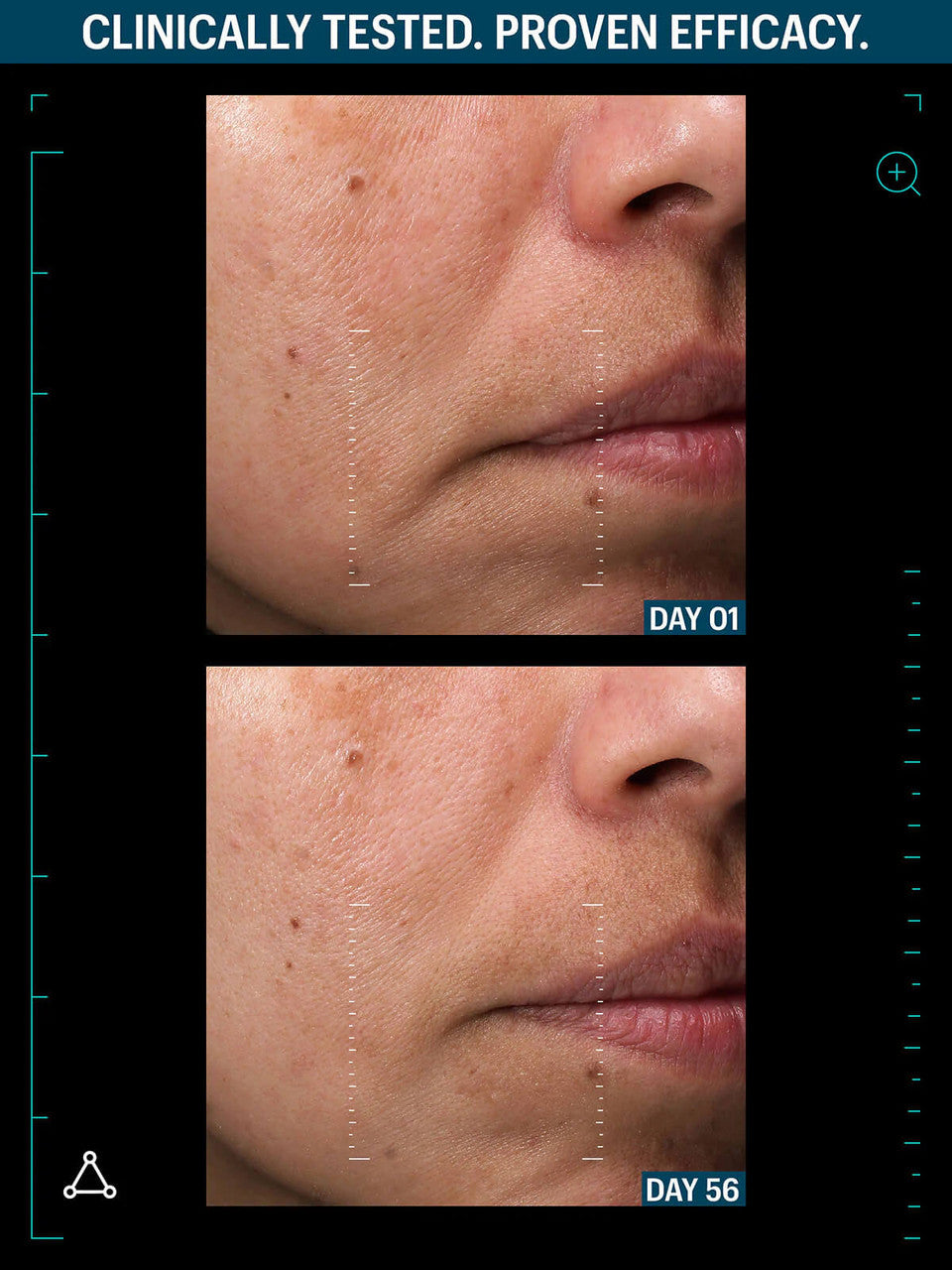 Allies of Skin Multi Peptides & GF Advanced Lifting Serum 1.7 fl oz - SkinElite - before & after 2