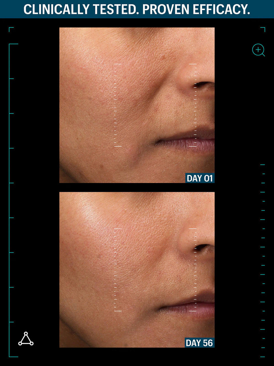 Allies of Skin Multi Peptides & GF Advanced Lifting Serum 1.7 fl oz - SkinElite - before & after 3