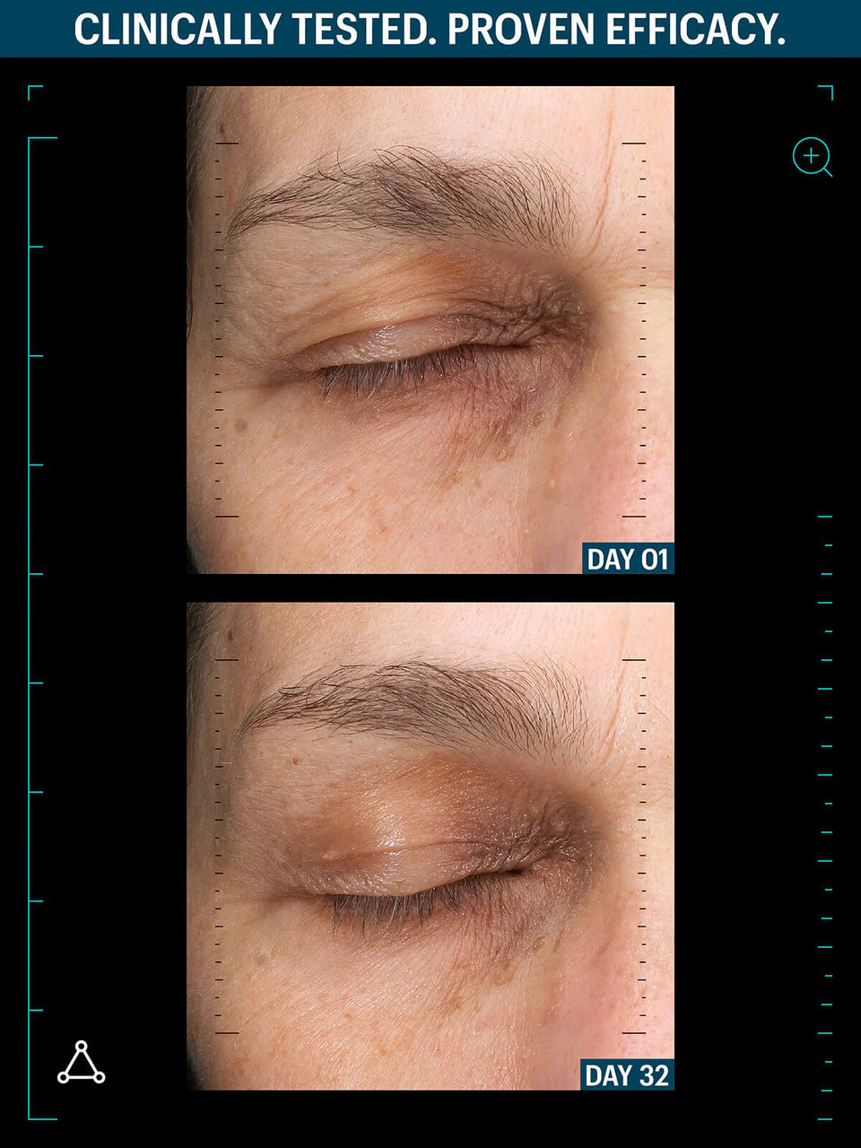 Allies of Skin Multi Peptides & GF Advanced Lifting Serum 1.7 fl oz - SkinElite - before & after 4