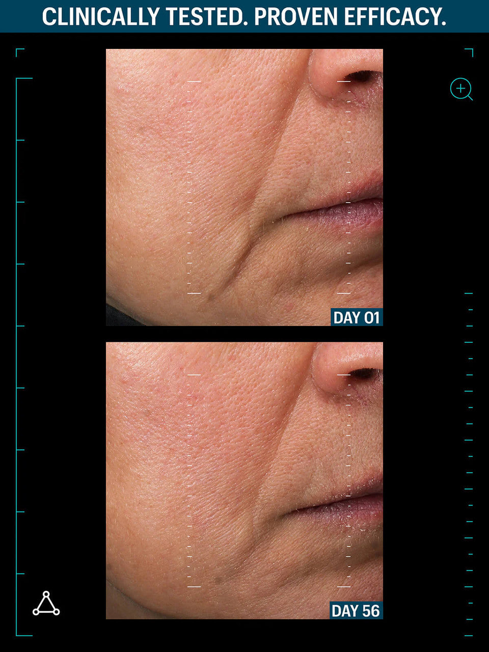 Allies of Skin Multi Peptides & GF Advanced Lifting Serum 1.7 fl oz - SkinElite - before & after 5