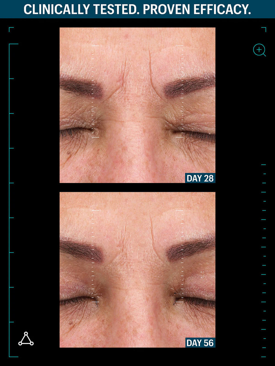 Allies of Skin Multi Peptides & GF Advanced Lifting Serum 1.7 fl oz - SkinElite - before & after 6