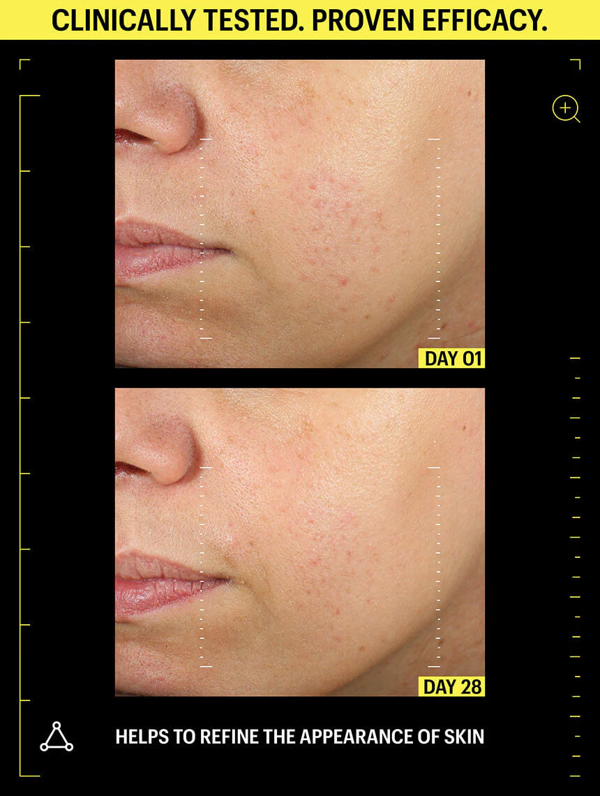Allies of Skin Retinal 0.1% & Peptides Repair Night Cream 1.6 fl oz - SkinElite - before & after 2