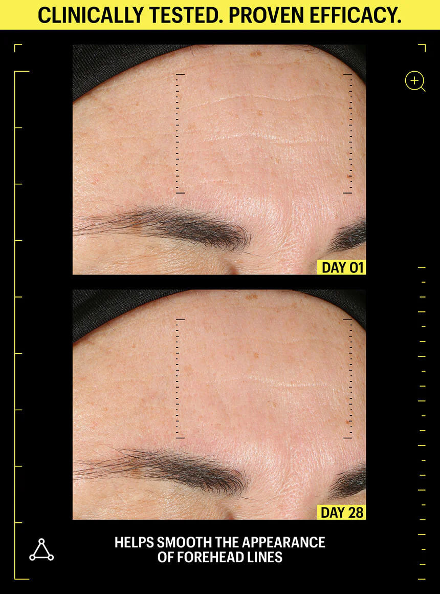 Allies of Skin Retinal 0.1% & Peptides Repair Night Cream 1.6 fl oz - SkinElite - before & after 4