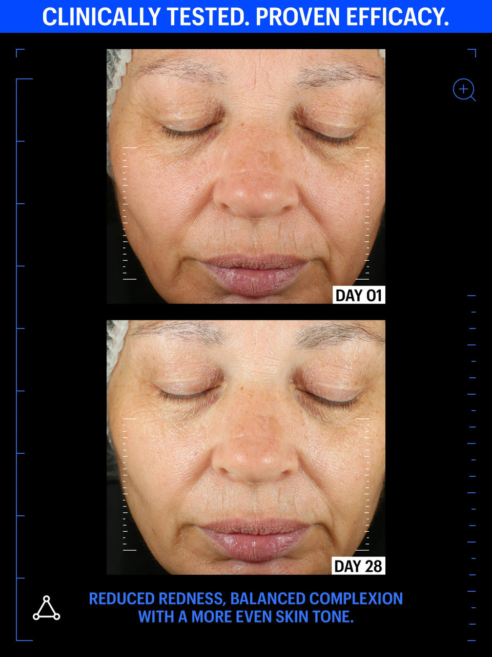 Allies of Skin Copper Tripeptide & Ectoin Advanced Repair Serum 1 fl oz - SkinElite - before and after 3