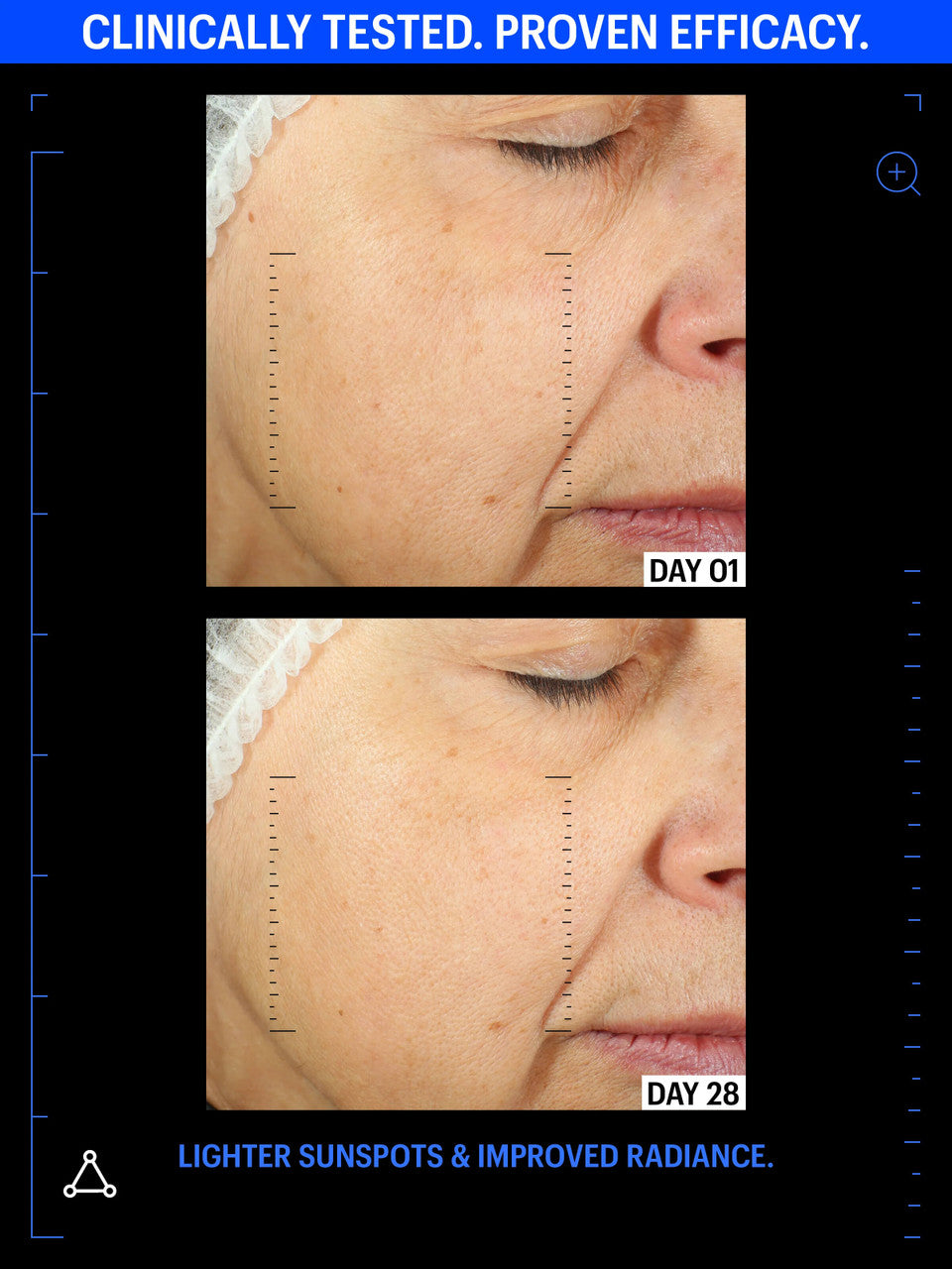 Allies of Skin Copper Tripeptide & Ectoin Advanced Repair Serum 1 fl oz - SkinElite - before and after 4