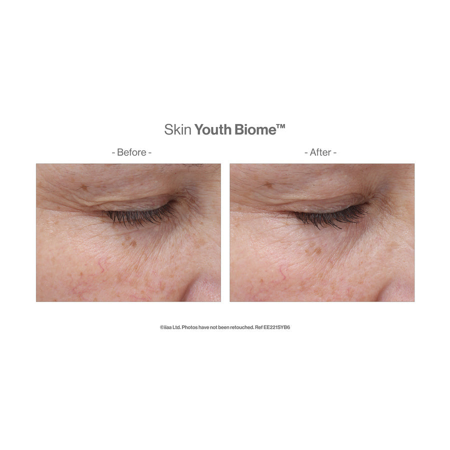 Jane Iredale Skin Youth Biome™ - 60 capsules - SkinElite - before and after 2