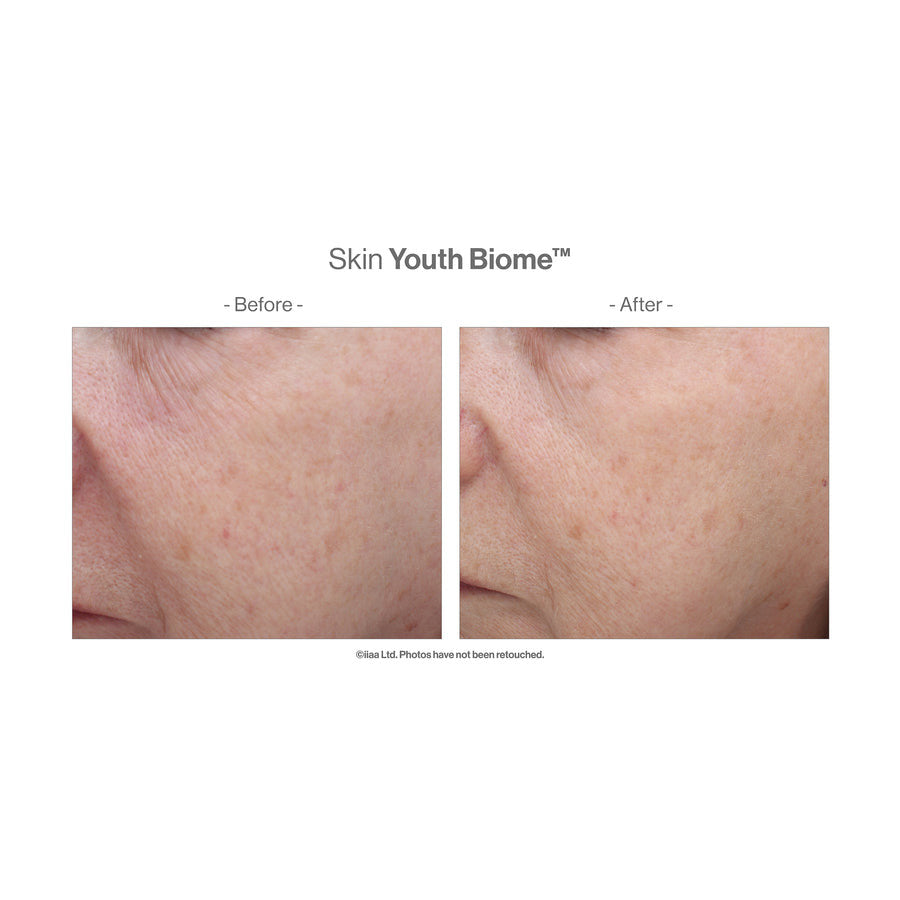 Jane Iredale Skin Youth Biome™ - 60 capsules - SkinElite - before and after 1