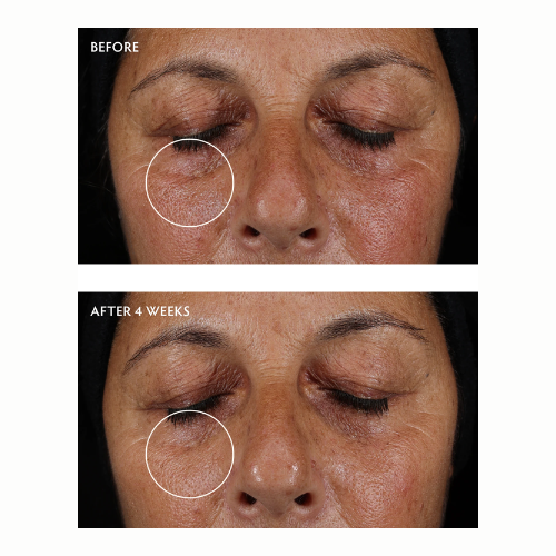Naturopathica Caffeine + Peptide Smoothing Eye Serum .5 oz - Skin Elite - before after