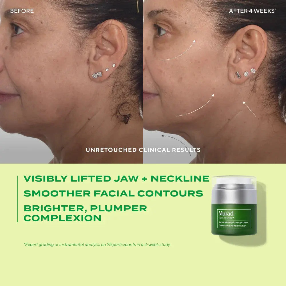 Murad Resurgence Retinal Overnight Cream 1.7 fl oz before and after 2