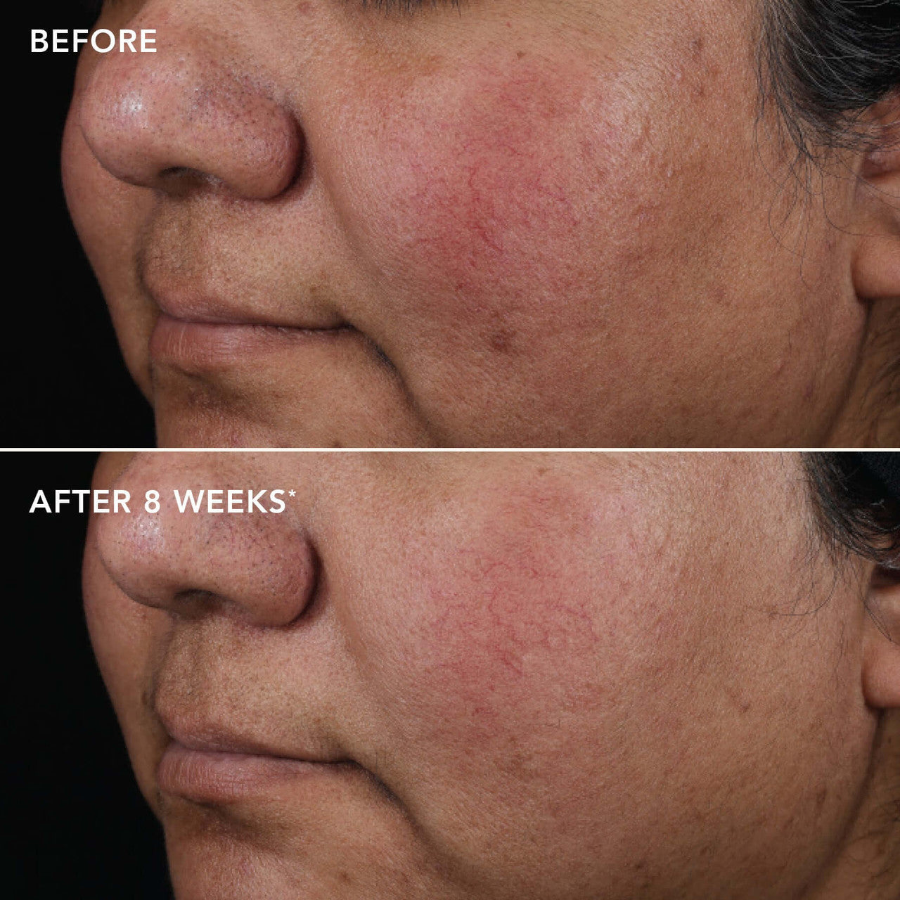 IMAGE AGELESS+ retinol pure liquid retinol 0.75% - SkinElite - before and after