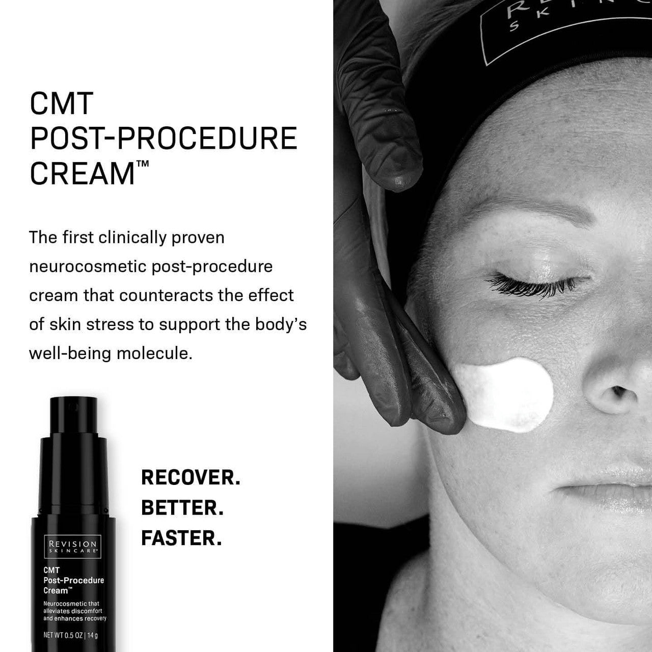 Revision CMT Post-Procedure Cream - SkinElite - benefits 2