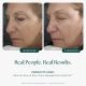 Jan Marini Age Intervention® Retinol Plus 1 oz - SkinElite - before and after
