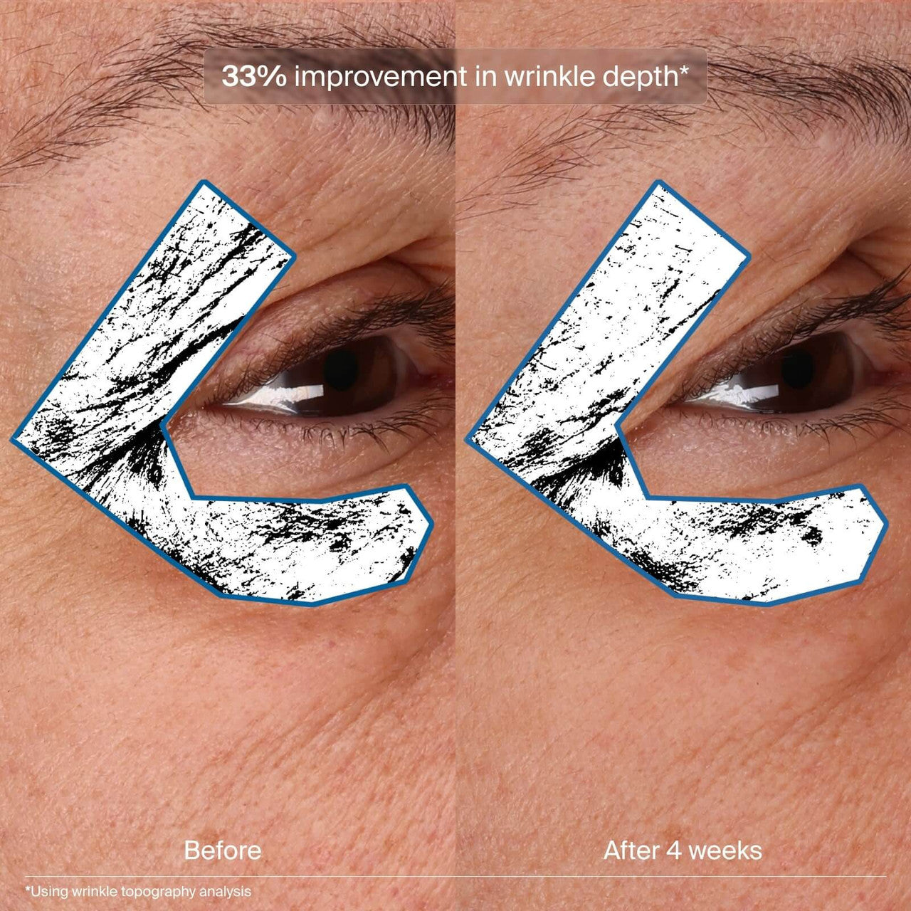 Pavise Bioadaptive Stress Repair 1 fl oz - SkinElite - Before and After 2