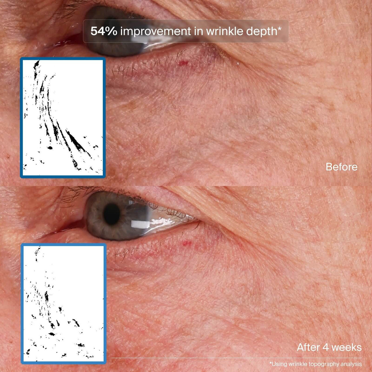 Pavise Bioadaptive Stress Repair 1 fl oz - SkinElite - Before and After 3