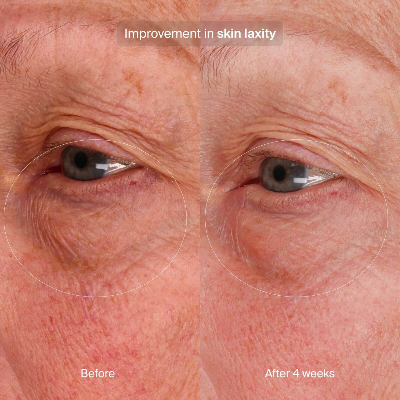 Pavise Bioadaptive Stress Repair 1 fl oz - SkinElite - Before and After 4