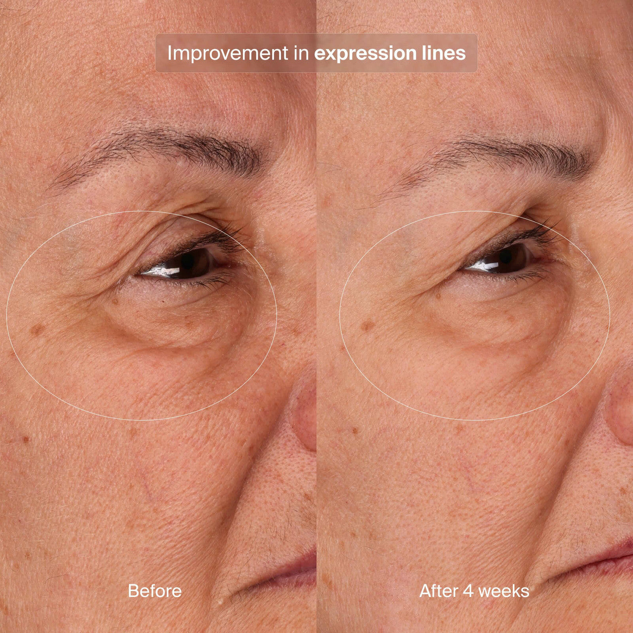 Pavise Bioadaptive Stress Repair 1 fl oz - SkinElite - Before and After 1