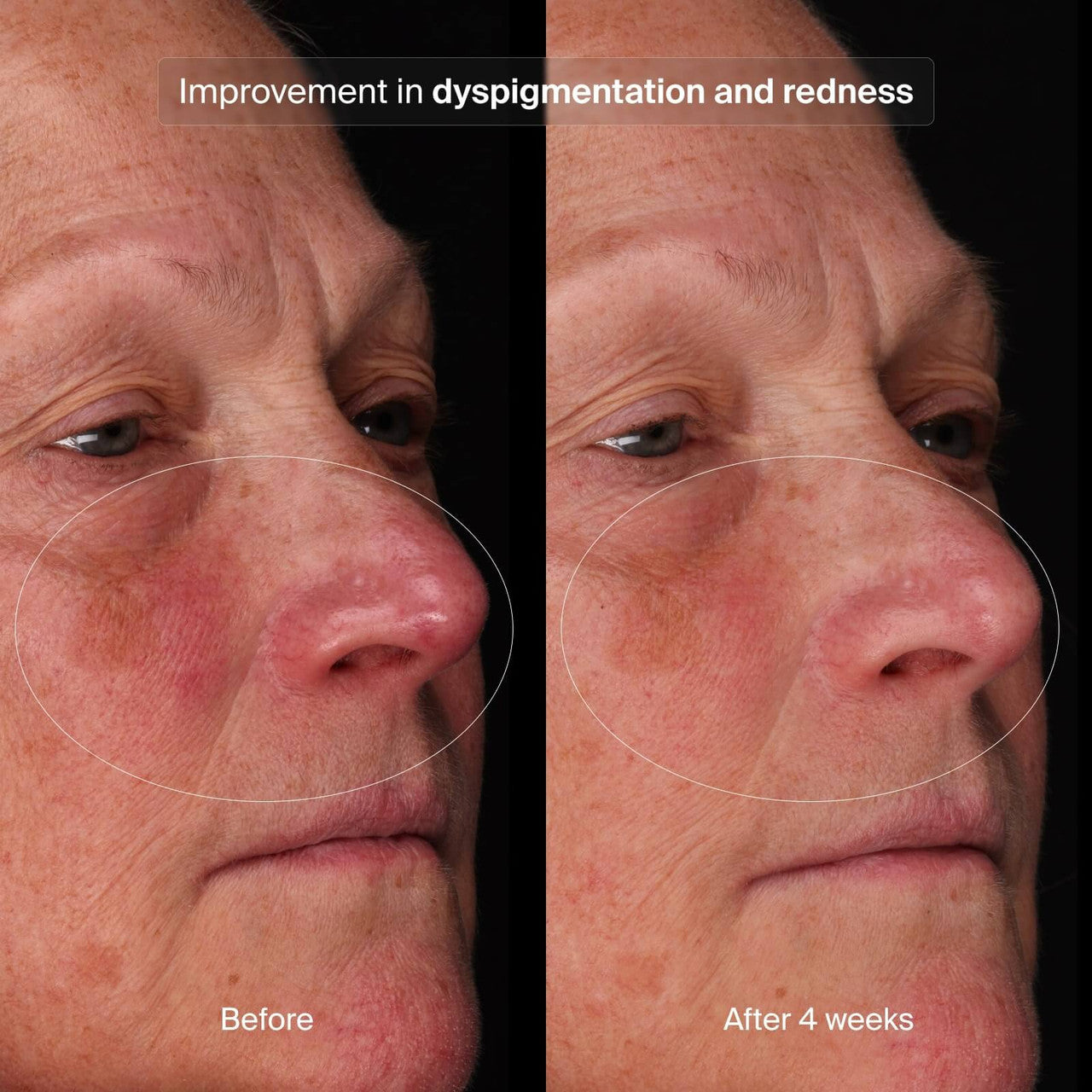 Pavise Bioadaptive Stress Repair 1 fl oz - SkinElite - Before and After 5