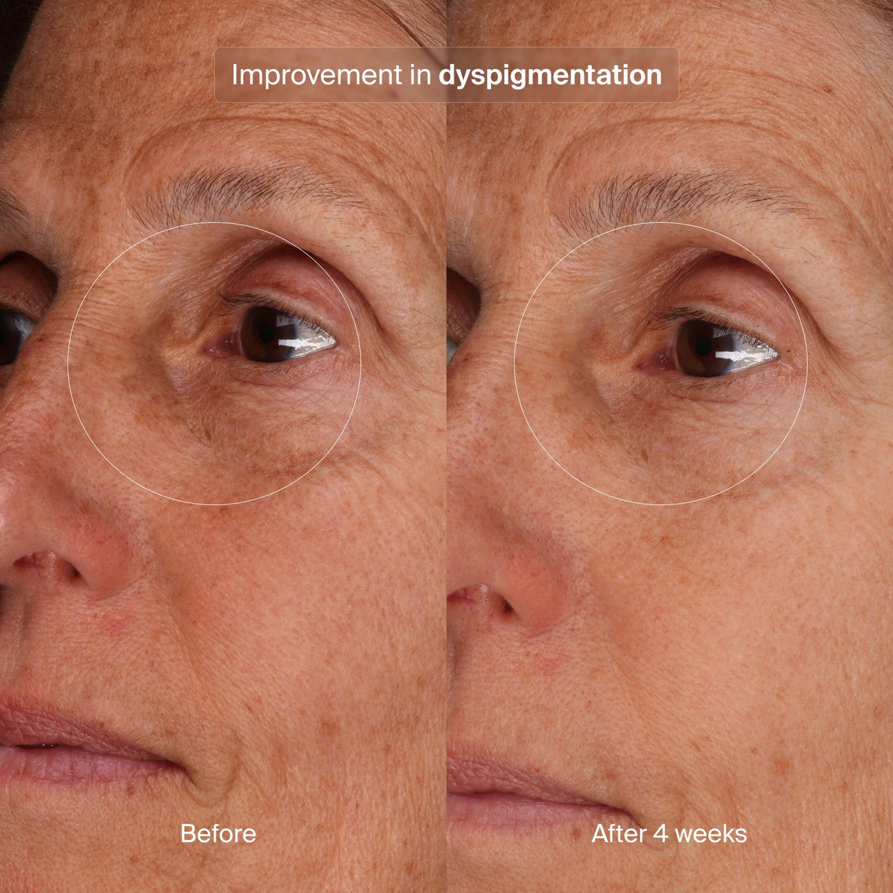 Pavise Bioadaptive Stress Repair 1 fl oz - SkinElite - Before and After 6