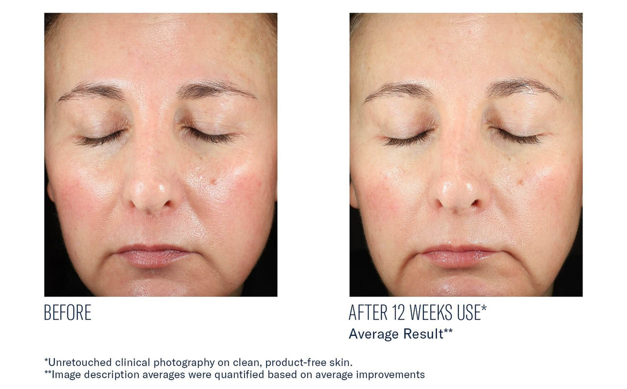 SkinBetter Science BioRewind Skin Health Dietary Supplement - 60 caps - SkinElite - before and after 2