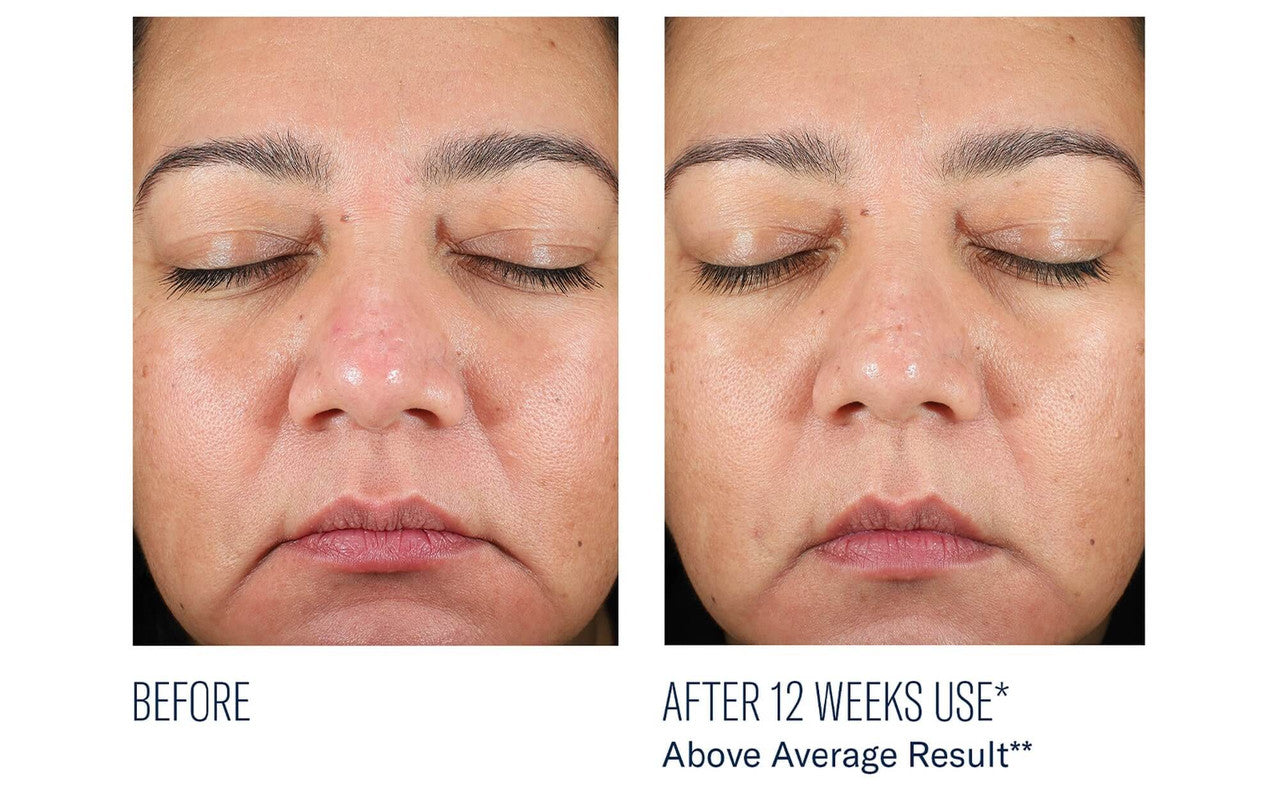 SkinBetter Science BioRewind Skin Health Dietary Supplement - 60 caps - SkinElite - before and after 3