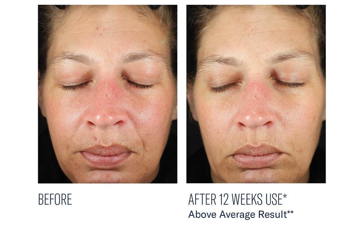SkinBetter Science BioRewind Skin Health Dietary Supplement - 60 caps - SkinElite - before and after 1