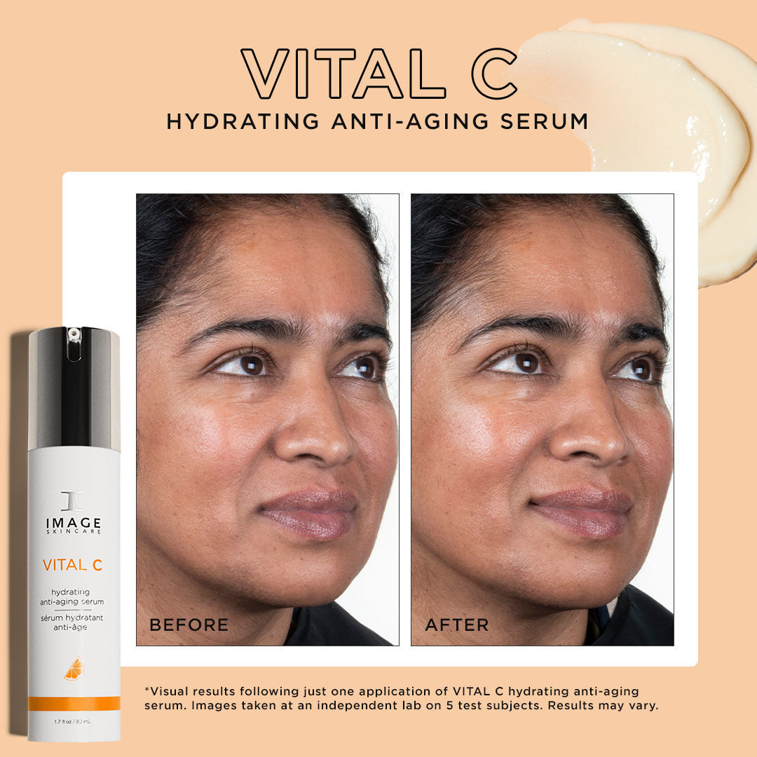 IMAGE VITAL C Hydrating Eye Recovery Gel 0.5 fl oz - SkinElite - before and after