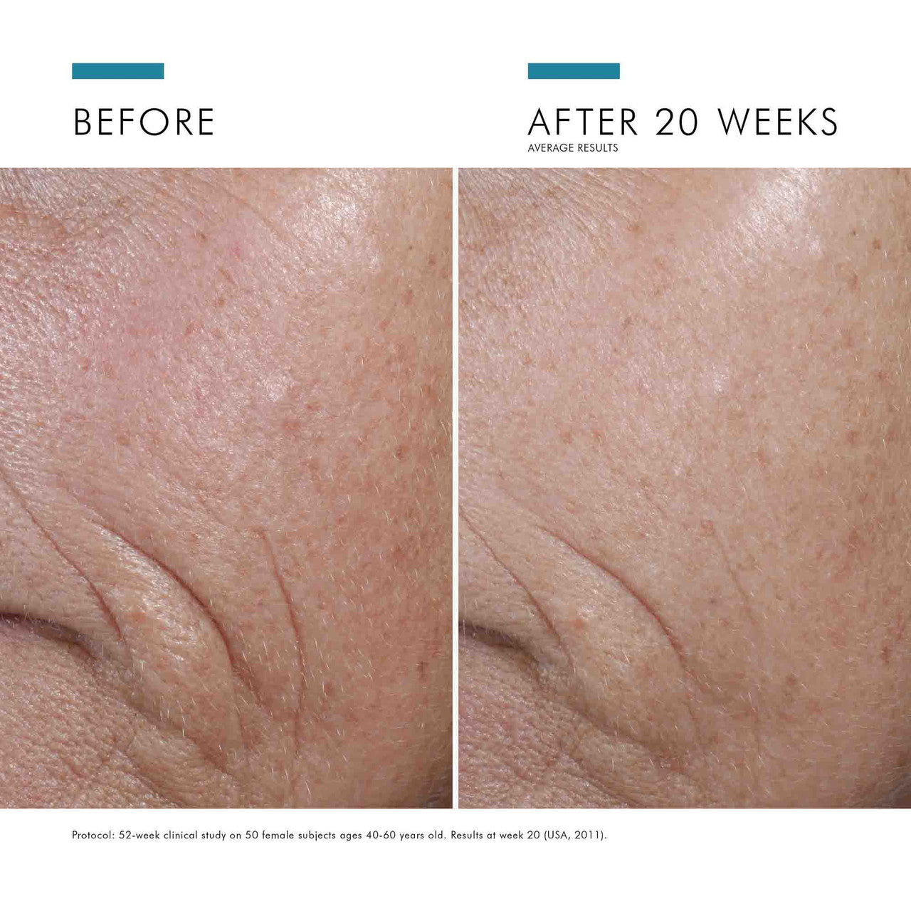 SkinCeuticals C E Ferulic® With 15% L-Ascorbic Acid 1 fl oz - SkinElite - before and after