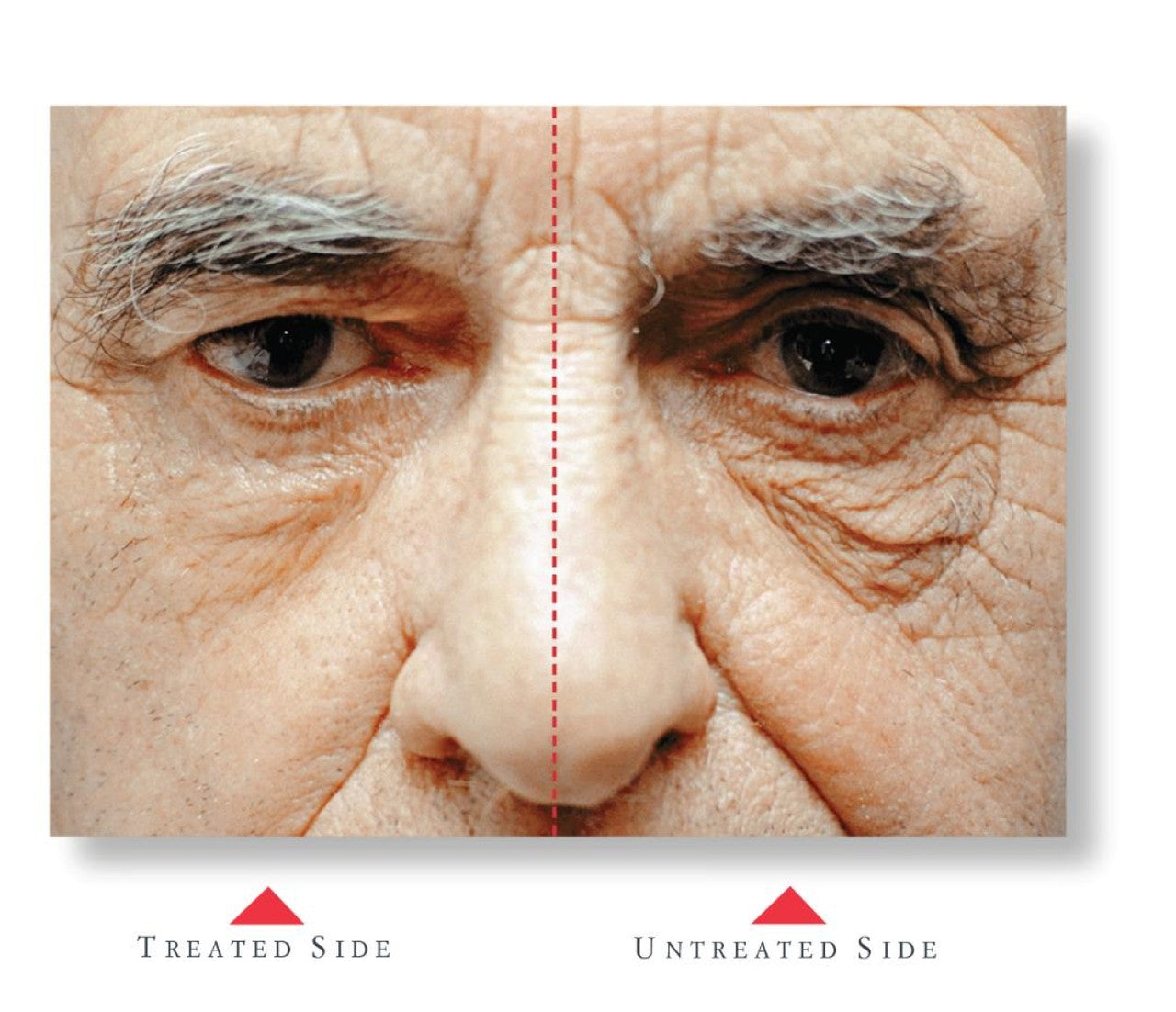 Cellex-C Advanced-C Serum - SkinElite - Results