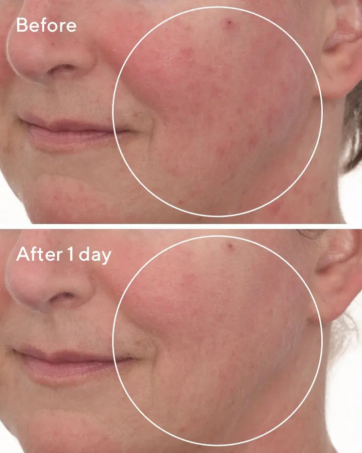Murad Cellular Hydration Barrier Repair Mask 2.7 oz before and after