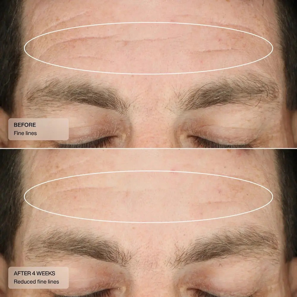 Senté Complete Repair System Kit before and after 1
