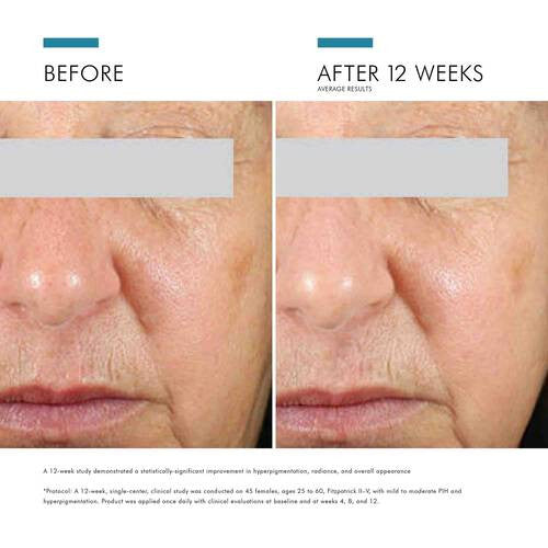 SkinCeuticals Daily Brightening UV Defense Sunscreen SPF 30 - 1 fl oz - SkinElite - before and after