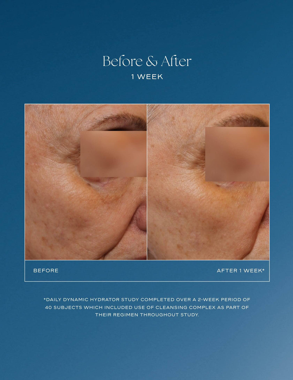 iS Clinical Daily Dynamic Hydrator 1.7 oz - Skin Elite - before and after 2