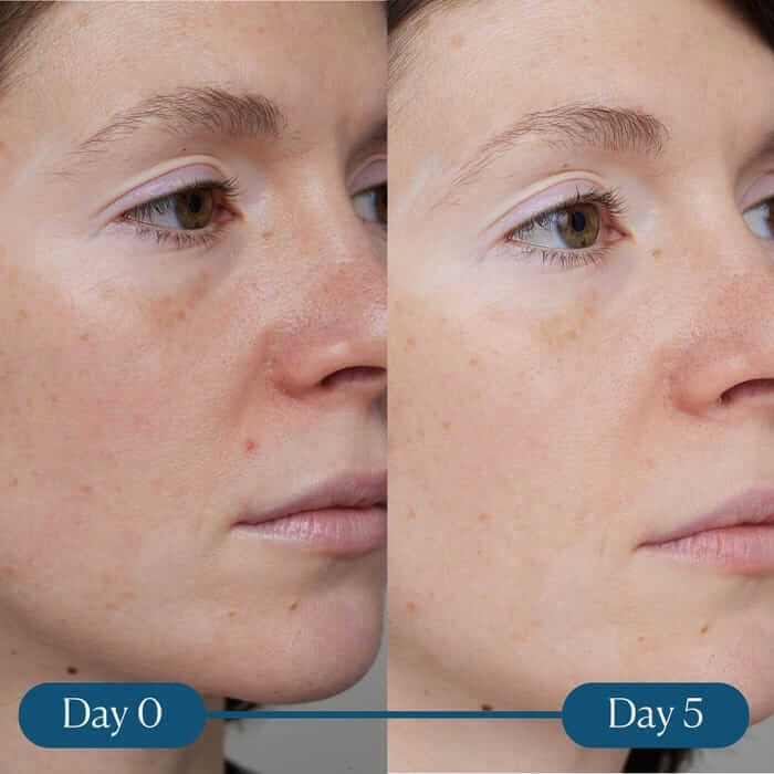 Elemis Dynamic Resurfacing Super-C Serum | SkinElite - before and after