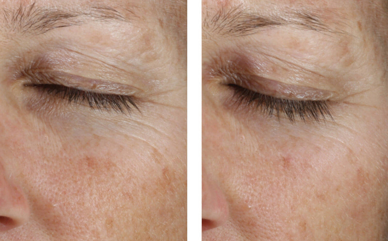 SkinBetter Science Instant Effect Gel EYE 0.5 fl oz - SkinElite - before and after