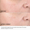 goop beauty GoopGlow 15% Glycolic Acid Overnight Glow Peel - 4 peels - Skin Elite - before and after