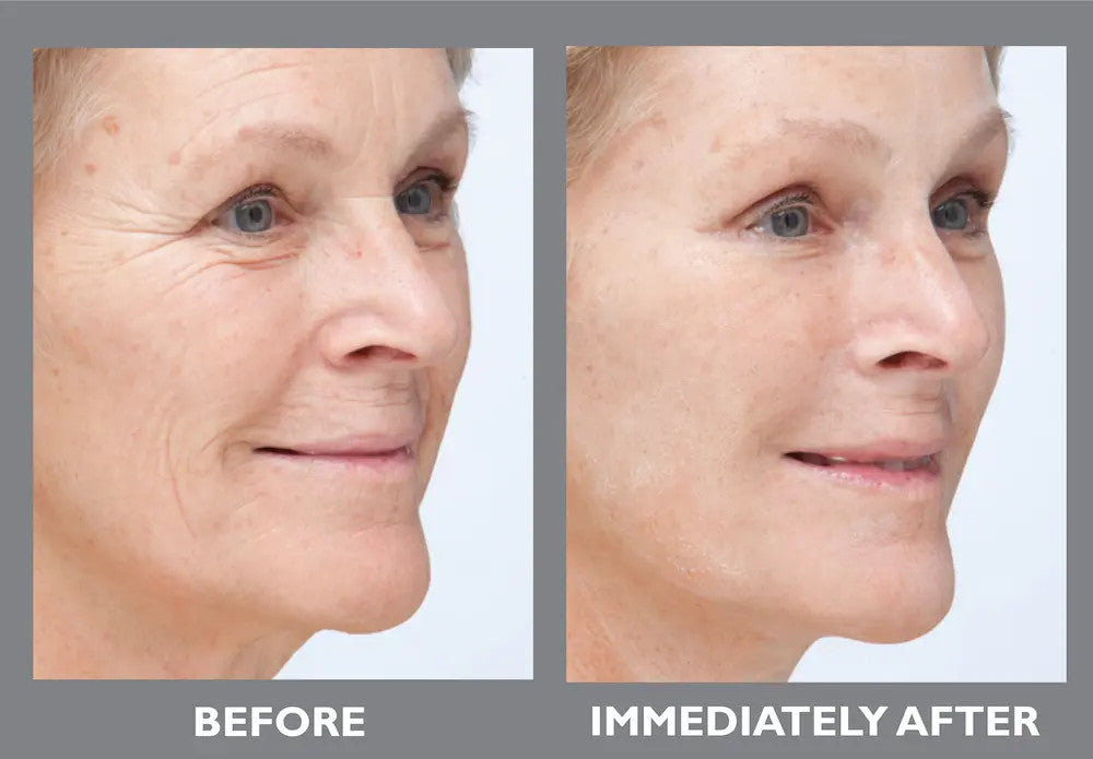 Peter Thomas Roth Instant FirmX Temporary Face Tightener 3.4 fl oz_before and after