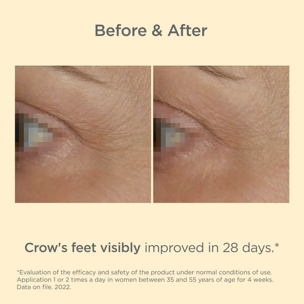 ISDIN Isdinceutics Vital Eyes Eye Cream 0.53 oz - SkinElite - before and after