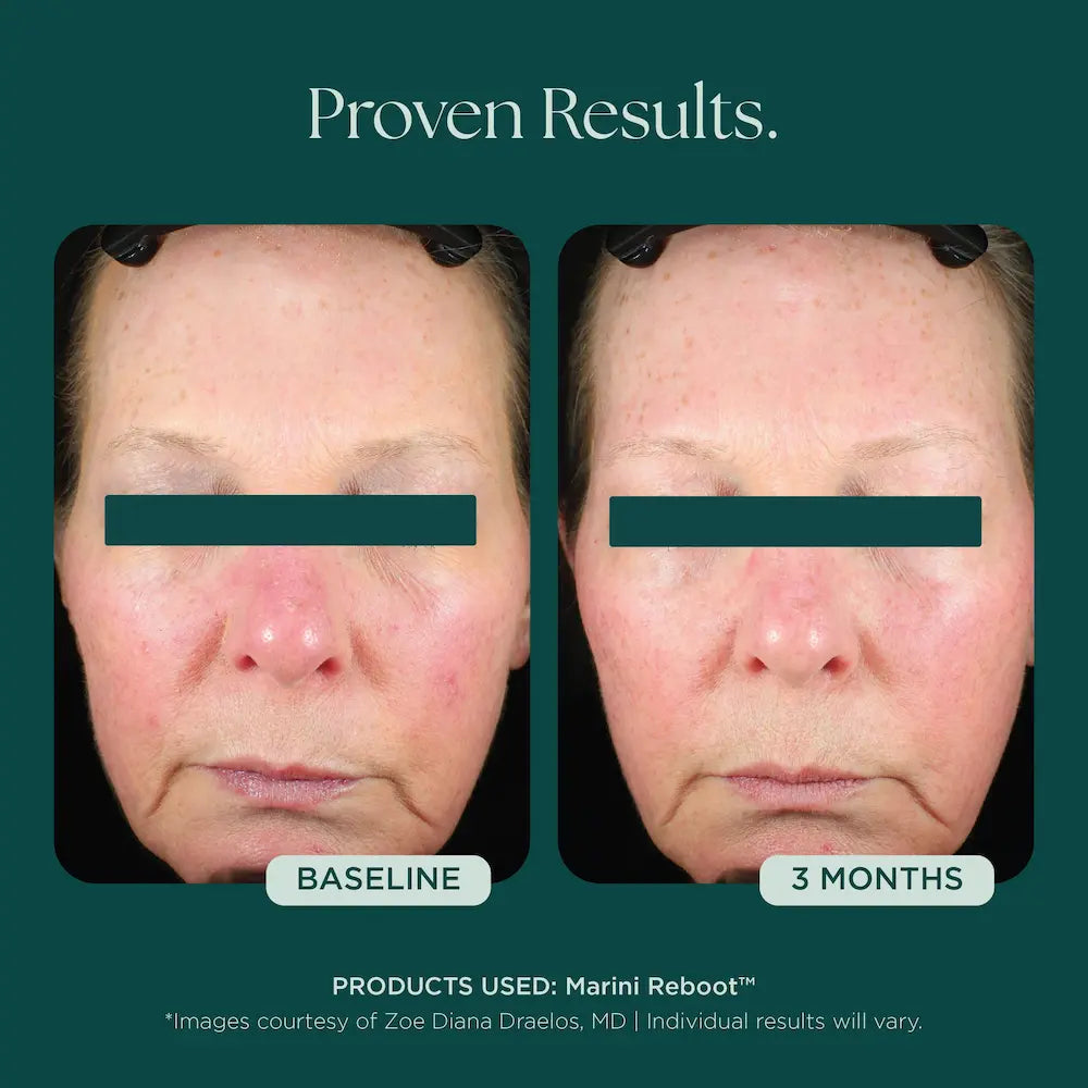 Marini SkinSolutions Marini Reboot® PDRN Face Serum 1 oz before and after 1