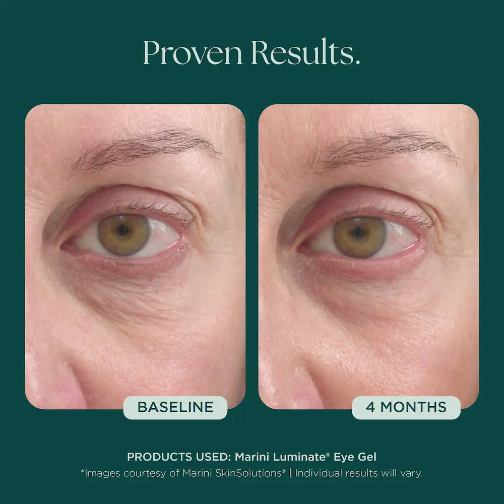 Marini SkinSolutions Marini Luminate® Eye Gel 0.5 oz